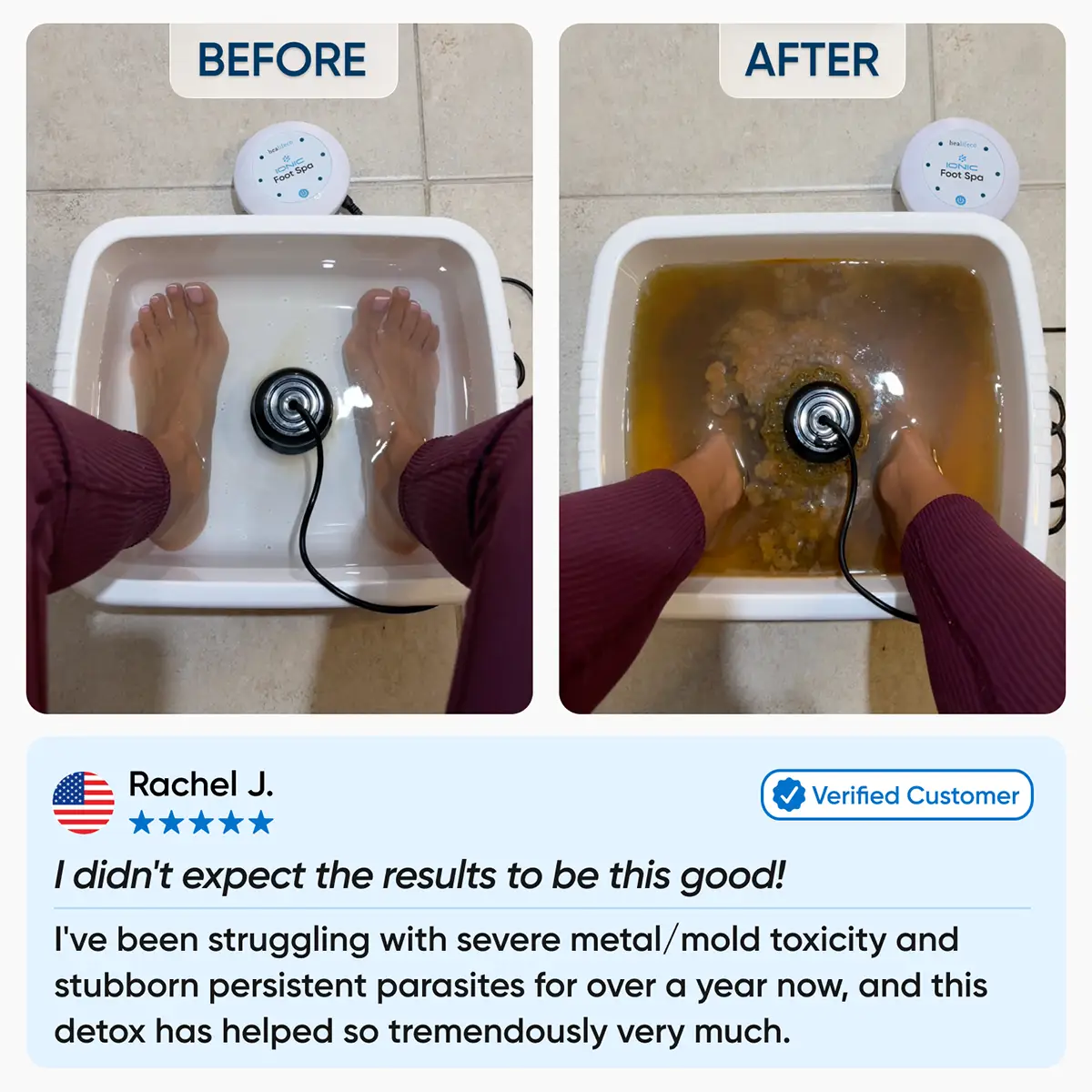 Harlin Ionic Foot Spa