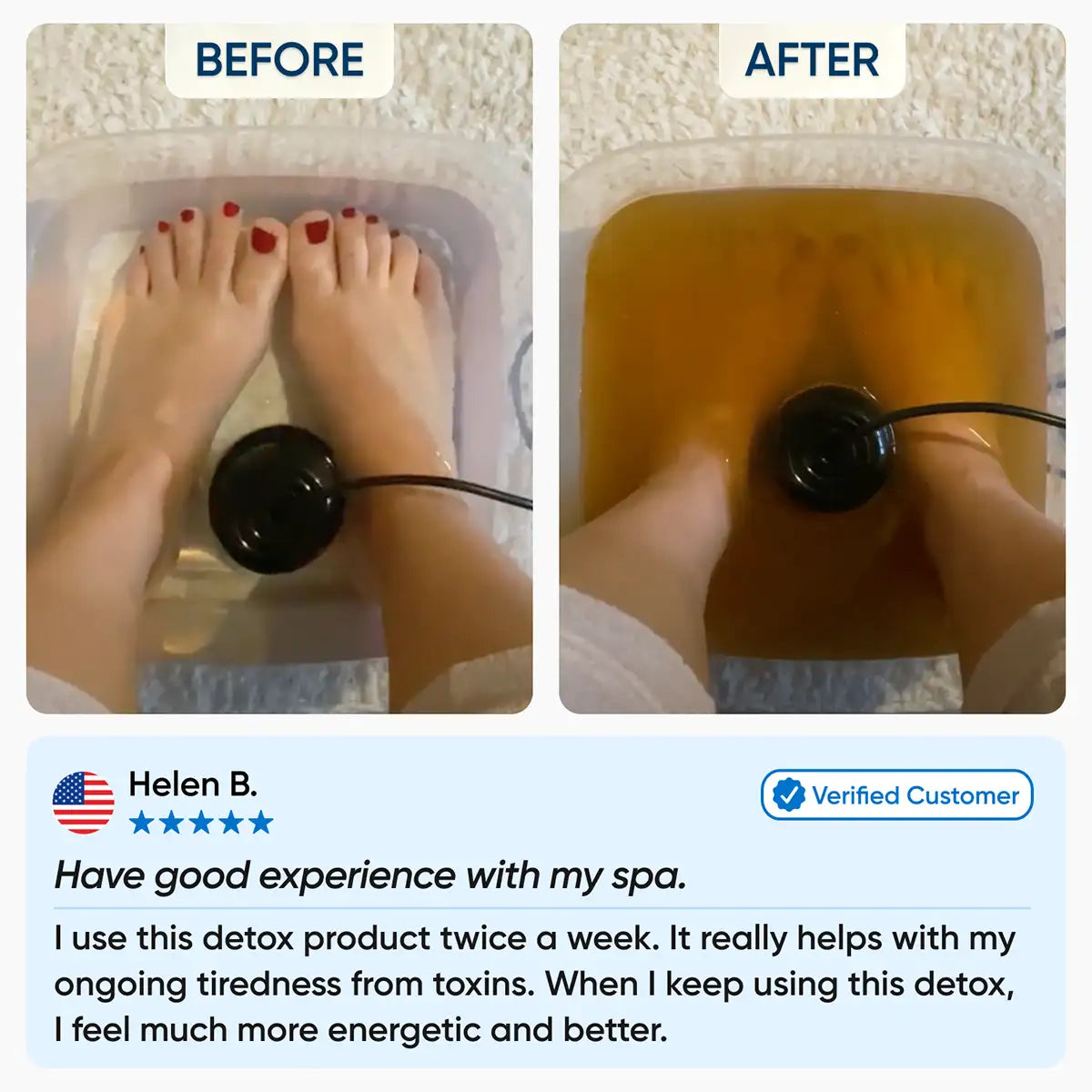 Harlin Ionic Foot Spa